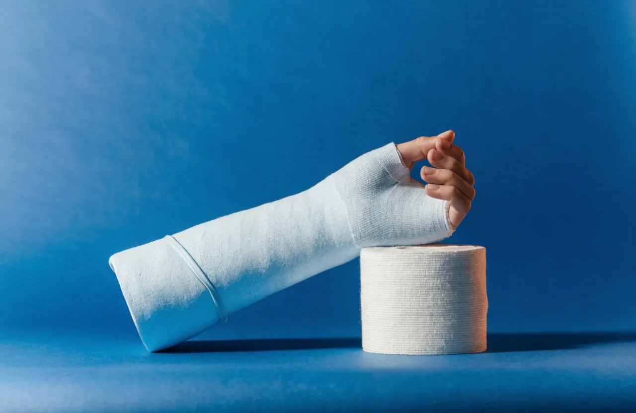 Fraturei um osso, e agora? O que fazer e como é a recuperação